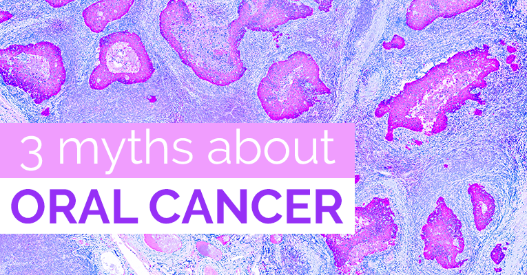 myths about oral cancer